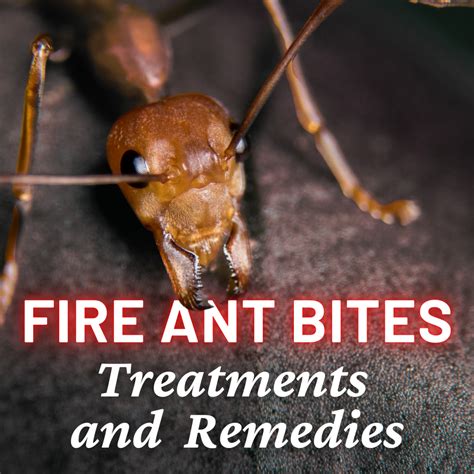 fire ants bites remedy